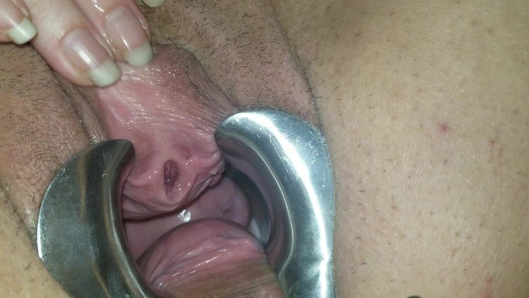 Urethral masturbation in women