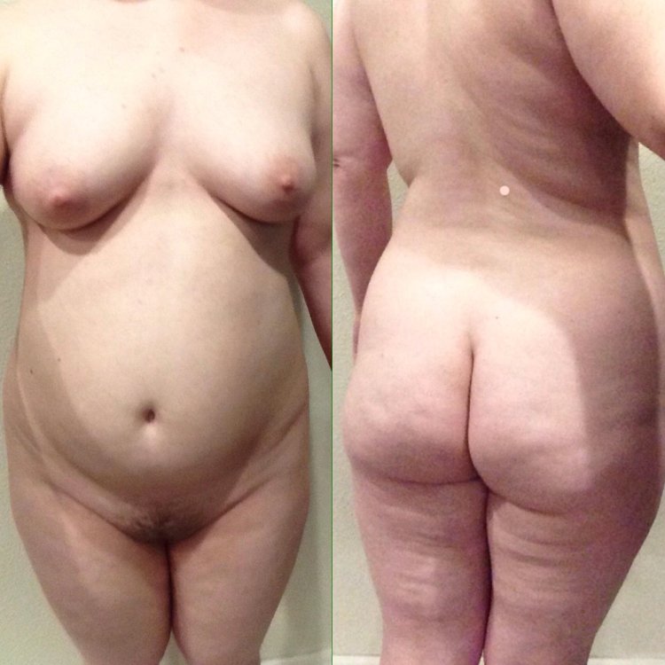 American xxx with stretch marks Photo