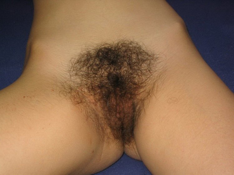 The most hairy female pubis