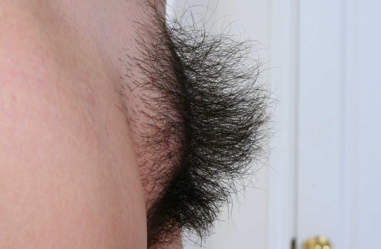 Adele Stepchens labia