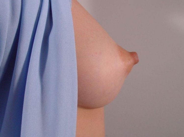 Nipples in mesh stockings