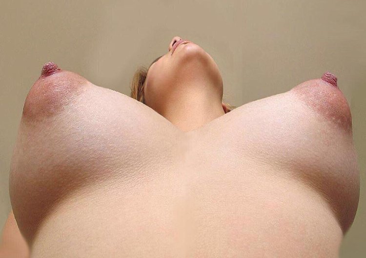Large excited nipples