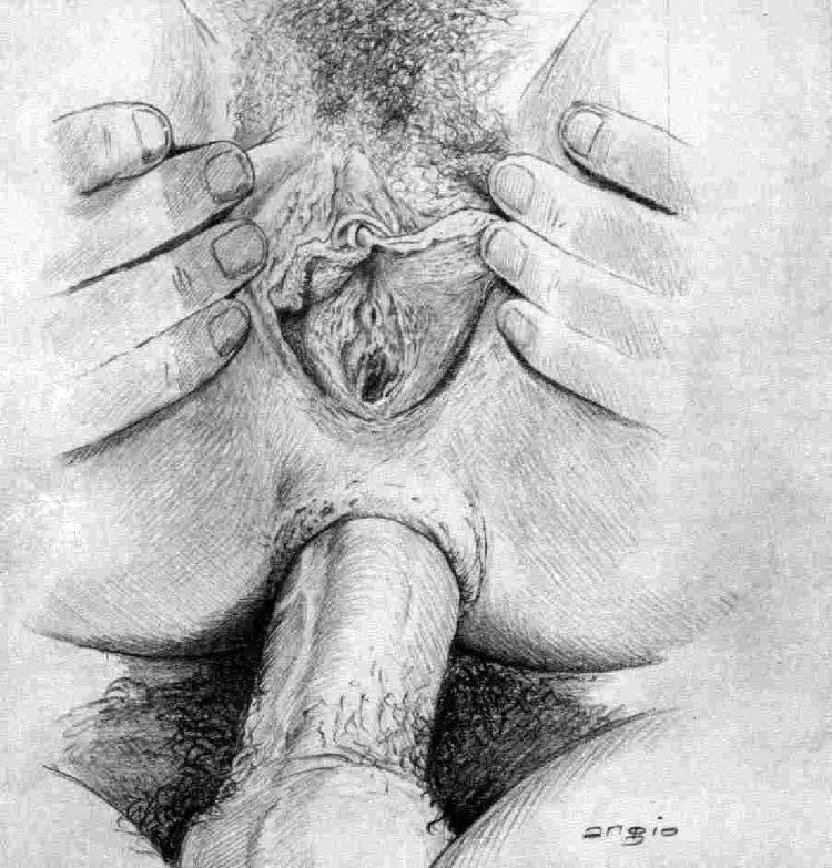 Armando Huert vagina