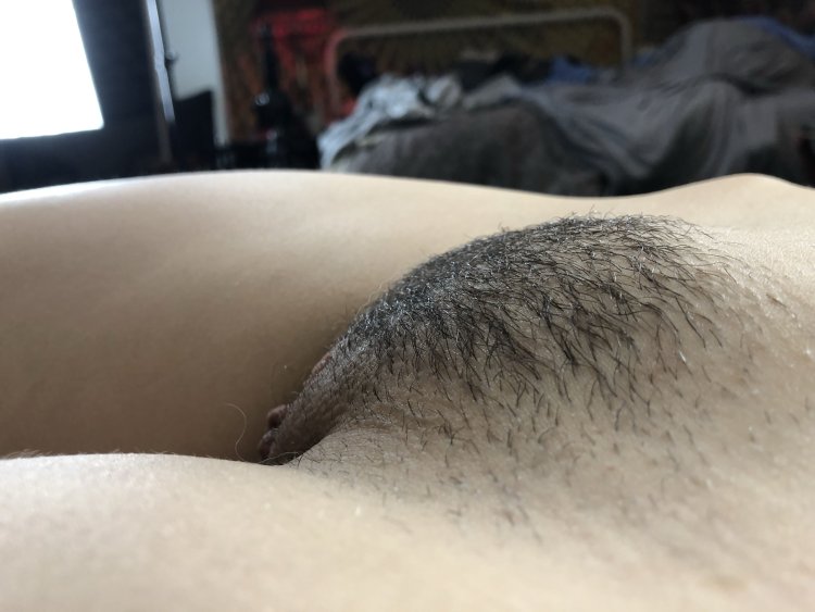A convex hairy pubis