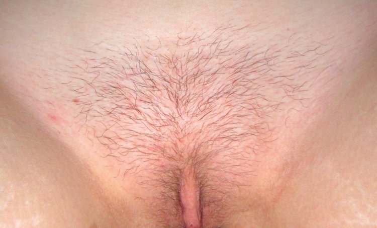 Blond hair on female pubis