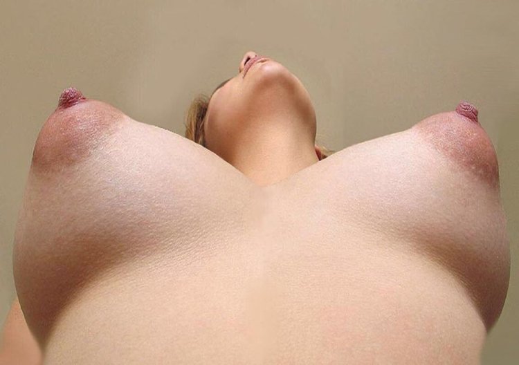 Large excited nipples