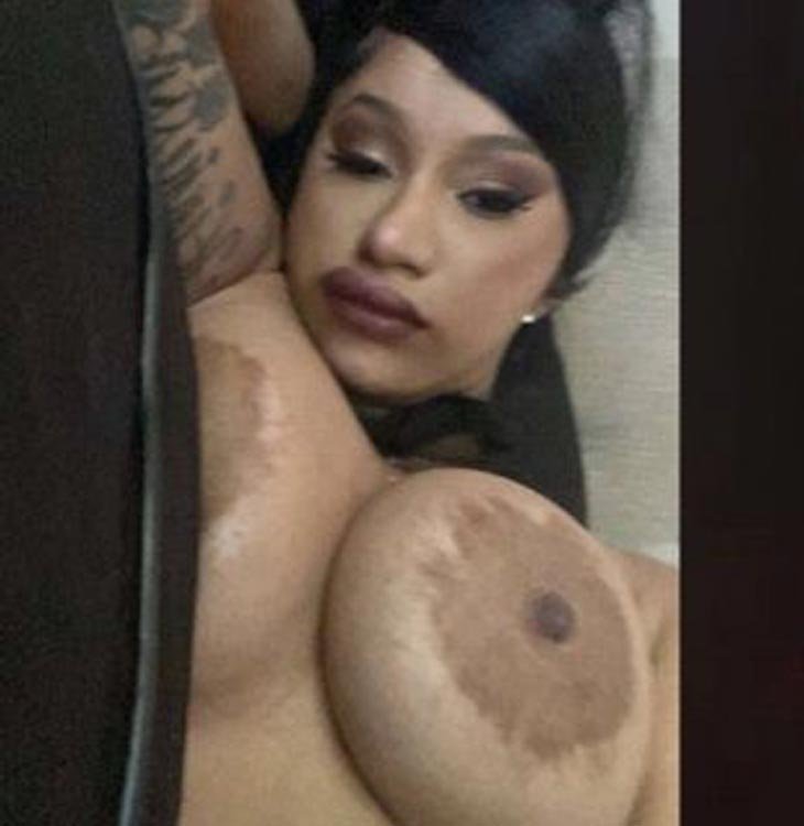 Cardi B chest drain