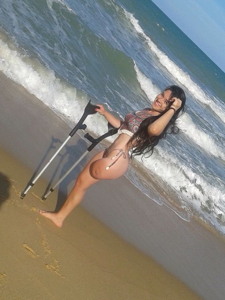 Anastasia Malenkova Amputy