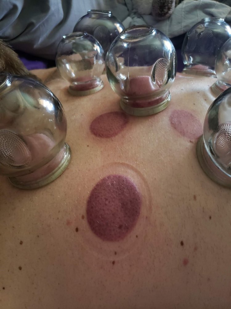 Joslyn Davis WTW is Fire Cupping Beauty Trippin