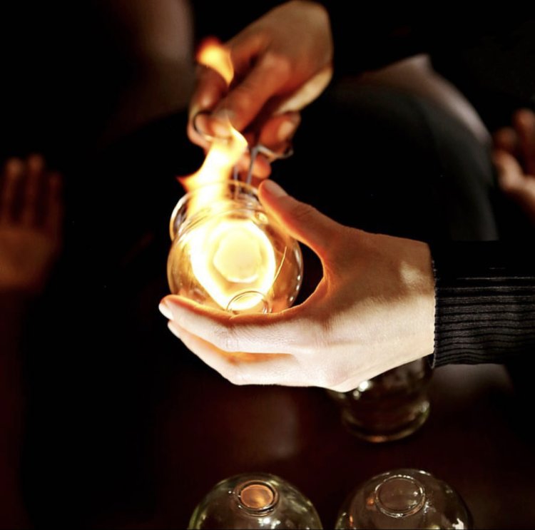 Fire Cupping Vacuum watch free