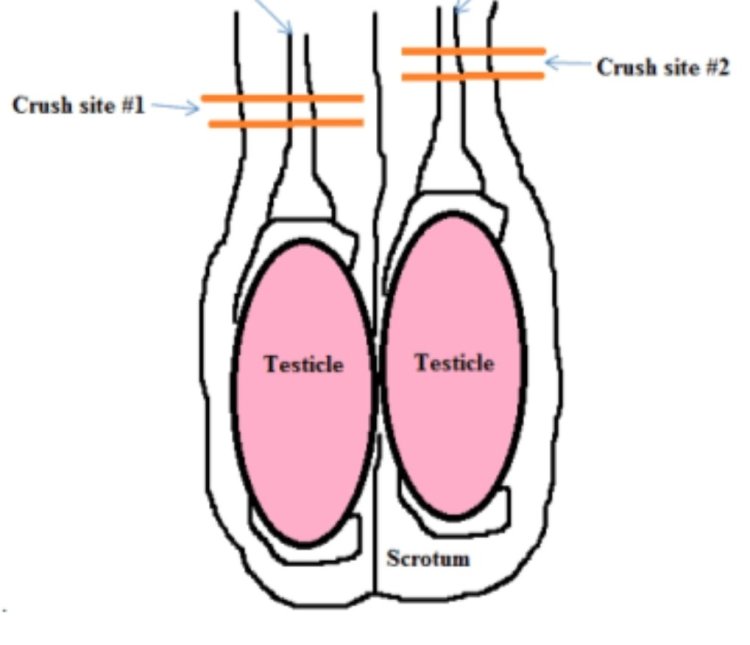 Mistress castration Burdizzo