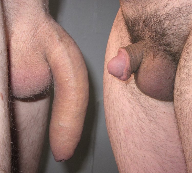 Small penis