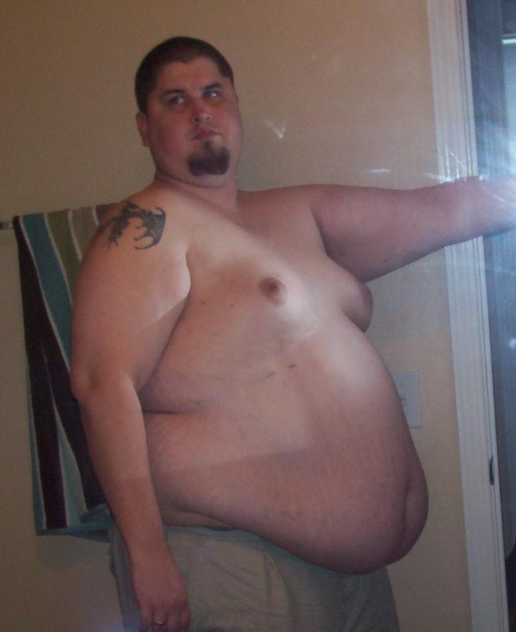 Pathological fat Albert