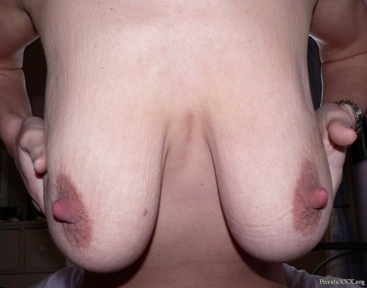 Sagging breasts with large nipples