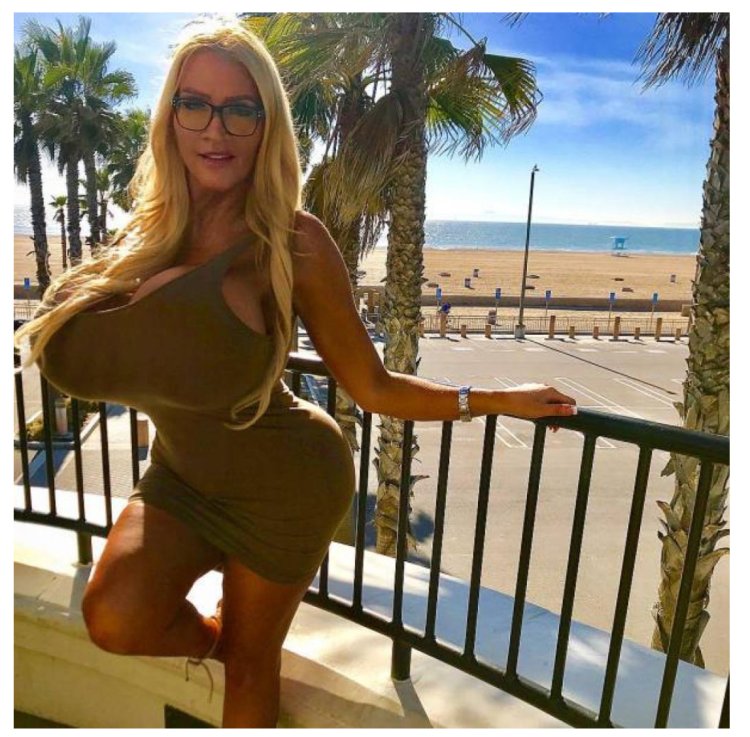 Allegra Cole before surgery and after