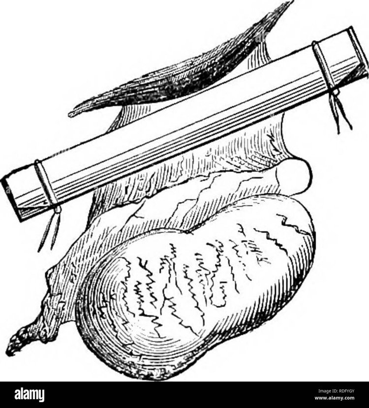 Captions castration in Russian