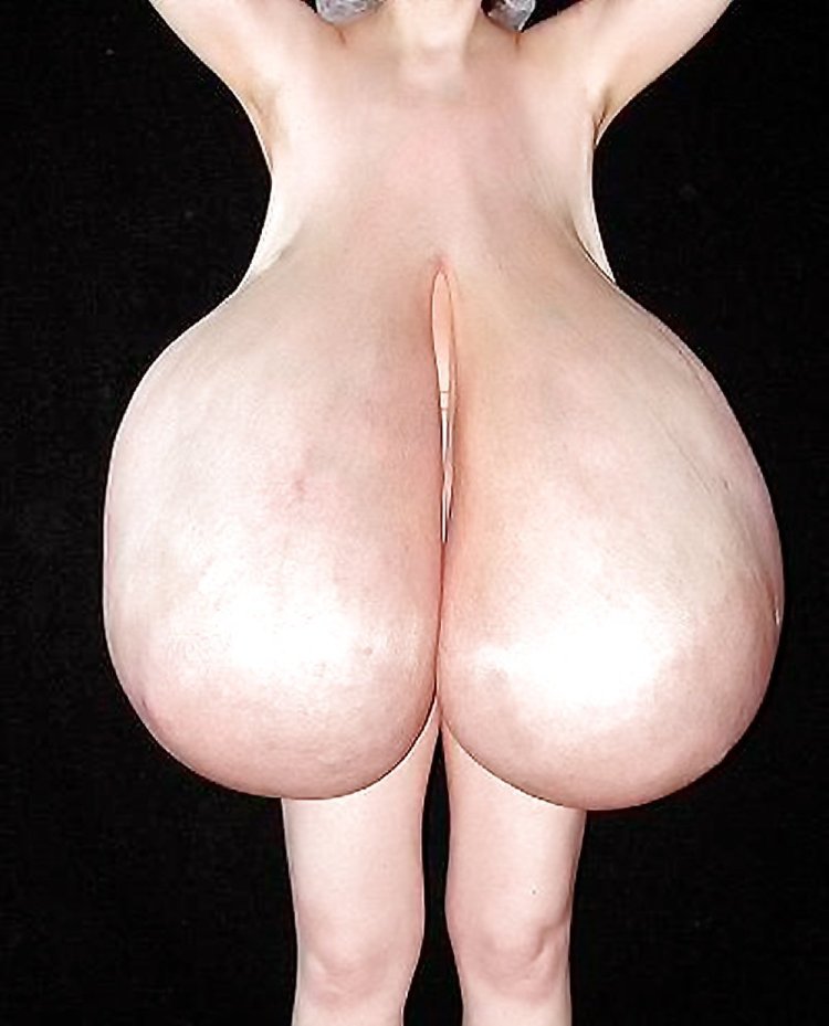 Macromastia in women naked