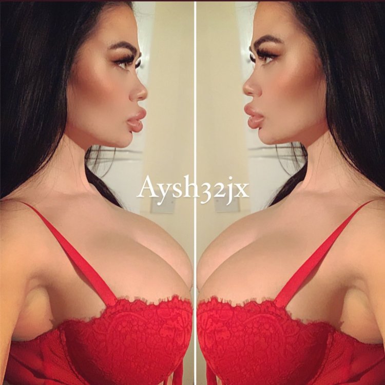 Silicone boobs and lips in underwear