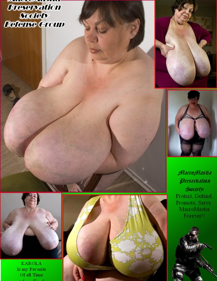 Macromastia of gigantomastia BBW