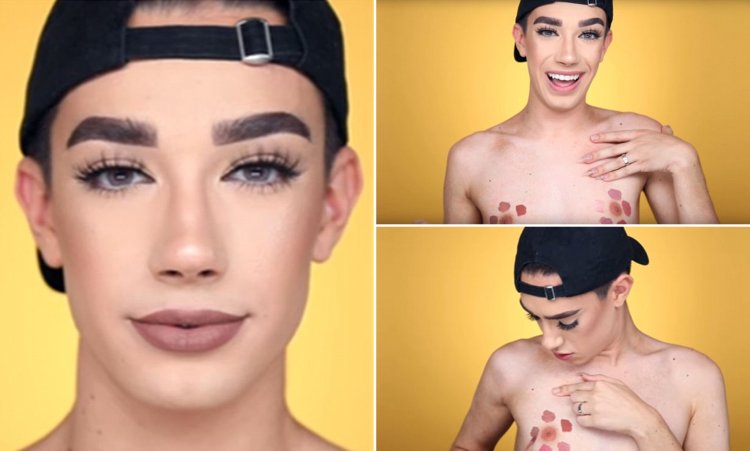 James Charles to plastic and after