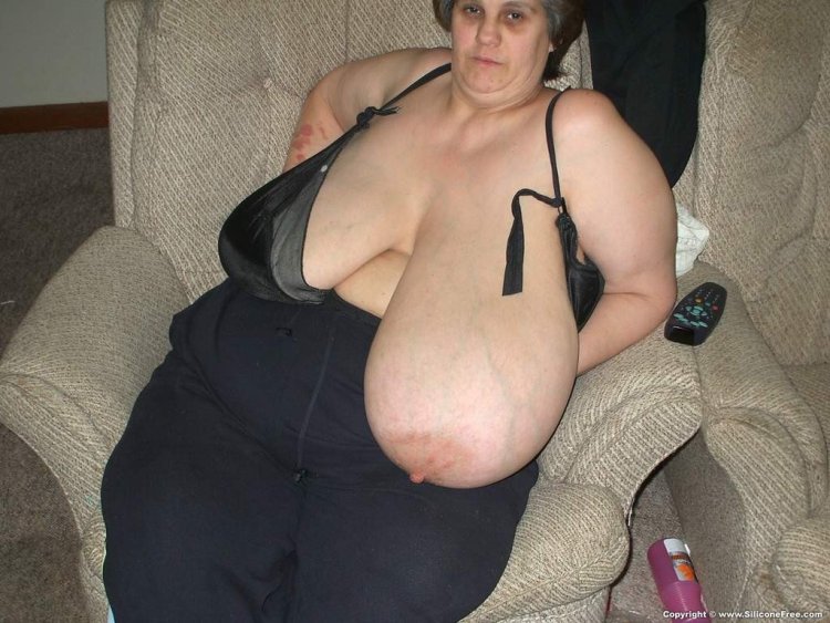 SSBBW Macomastia Tits