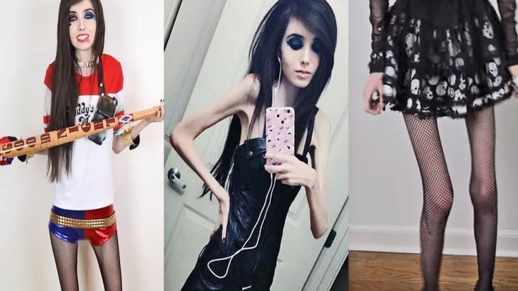 Eugenia Cooney anorexia
