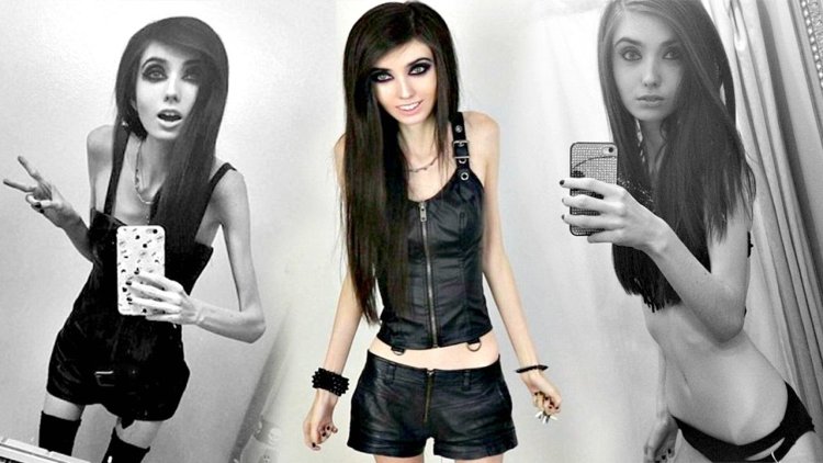 Eugenia Cooney anorexia