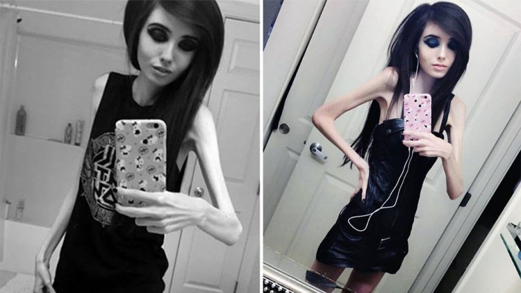 Eugenia Cooney legs