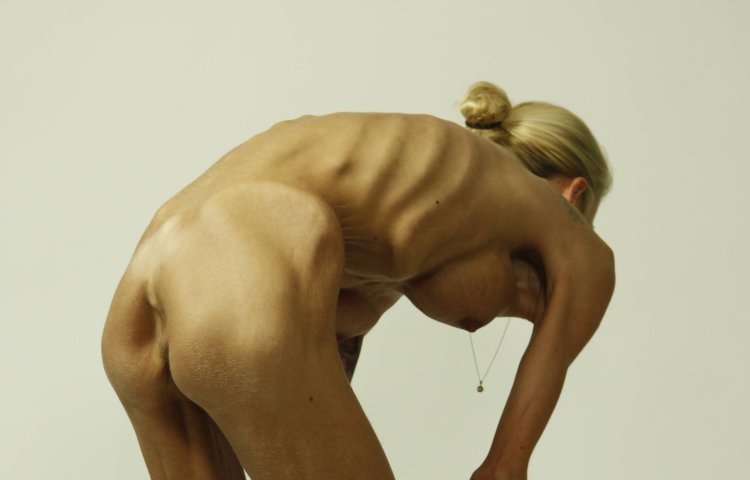 Anorexics with huge tits