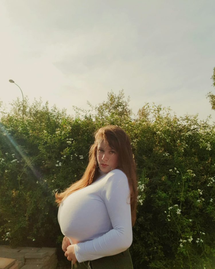 Macromastia of Grenny gigantomastia