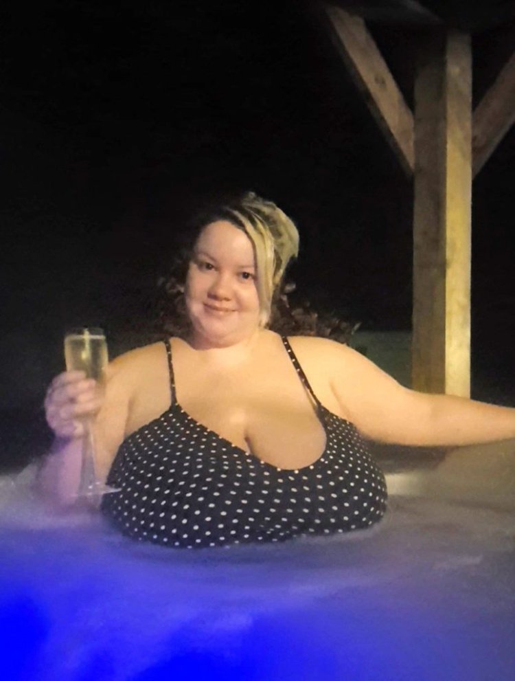 Women with macromastia