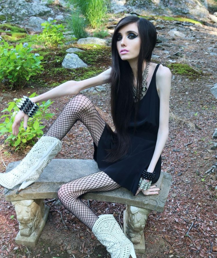 Eugenia Cooney anorexia