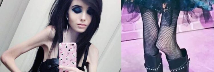 Eugenia Cooney anorexia