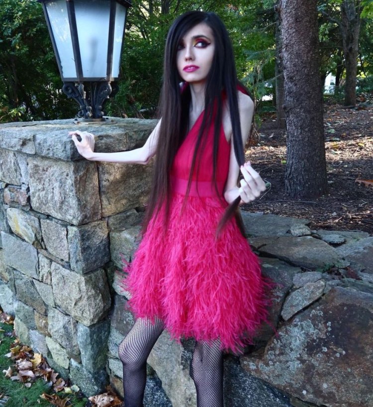 Eugenia Cooney anorexia