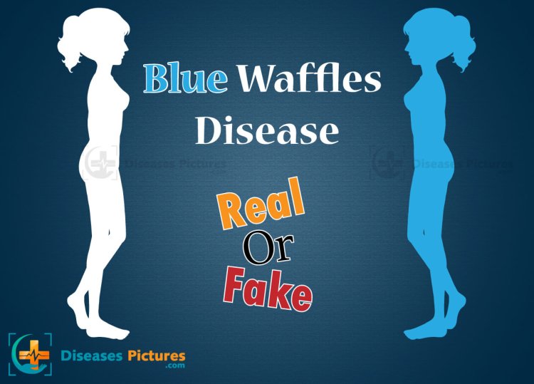 Blue waffles