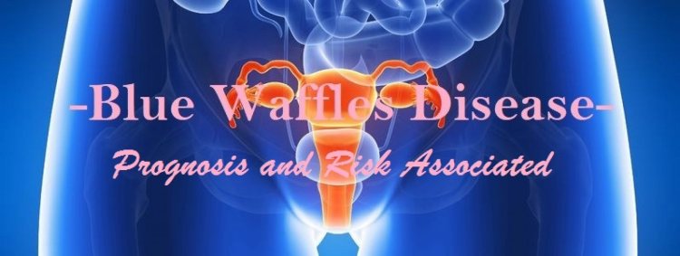 Blue waffles that cannot