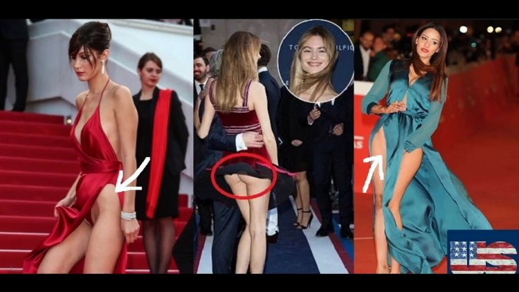 "UPS": stars who failed the skirt