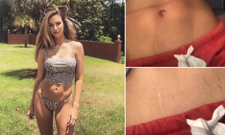 Nude BBW Mature Ugly Cellululit tummy