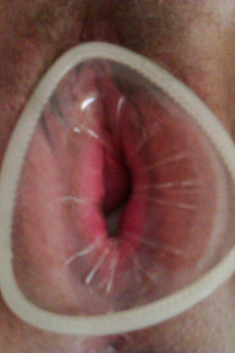 Women's condom in vagina