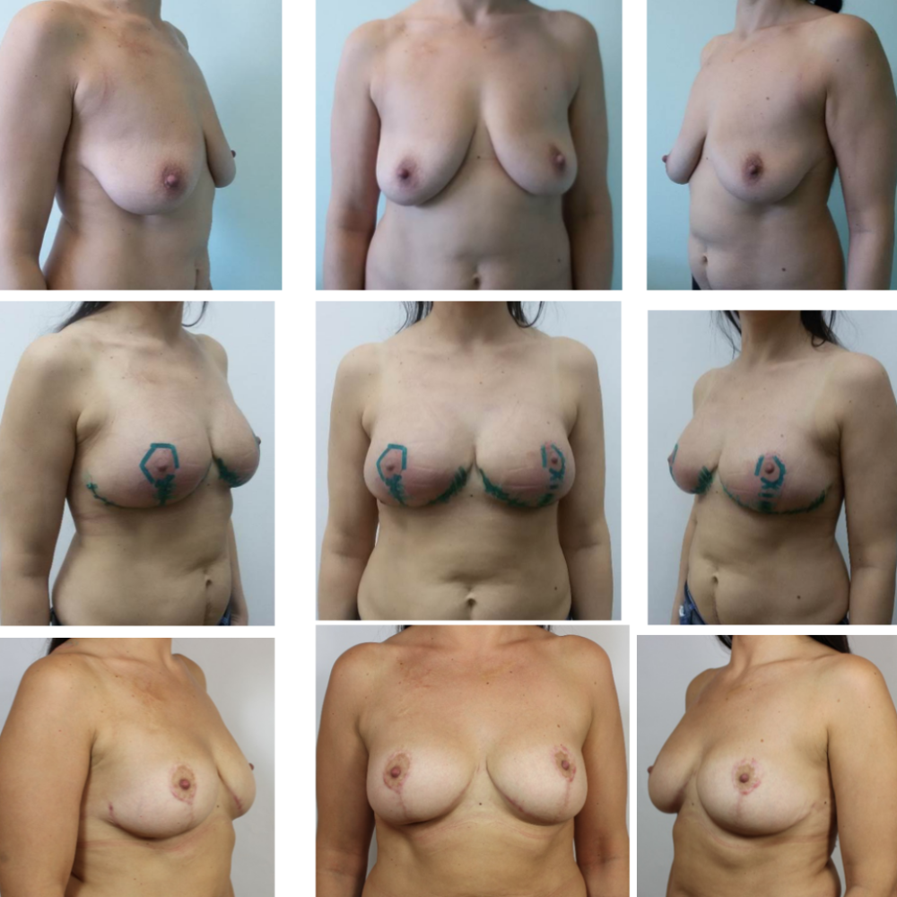 Tits of different shapes and sizes