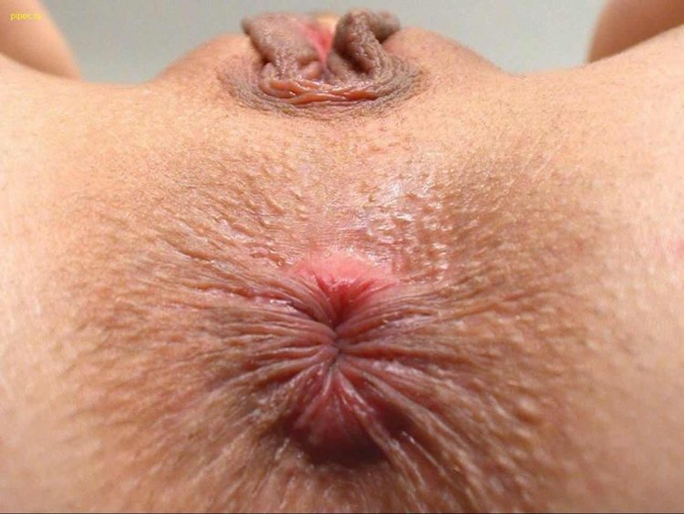 Stretching female anus