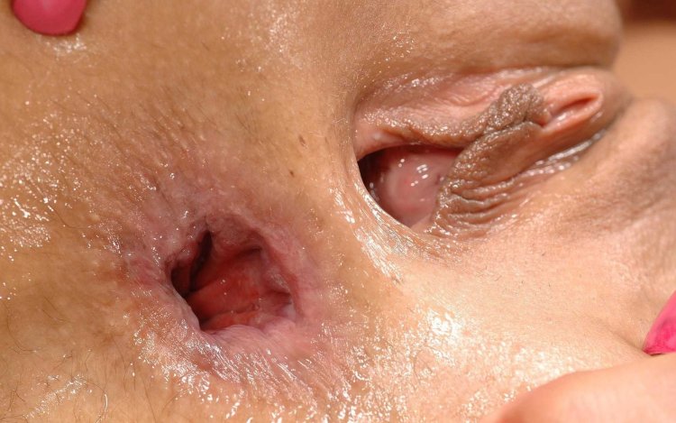 Anal hole close-up