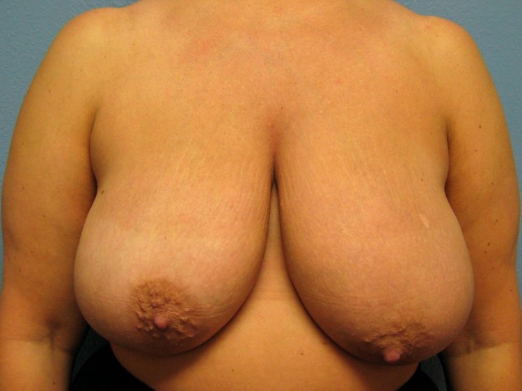 Women's chest drawn nipples