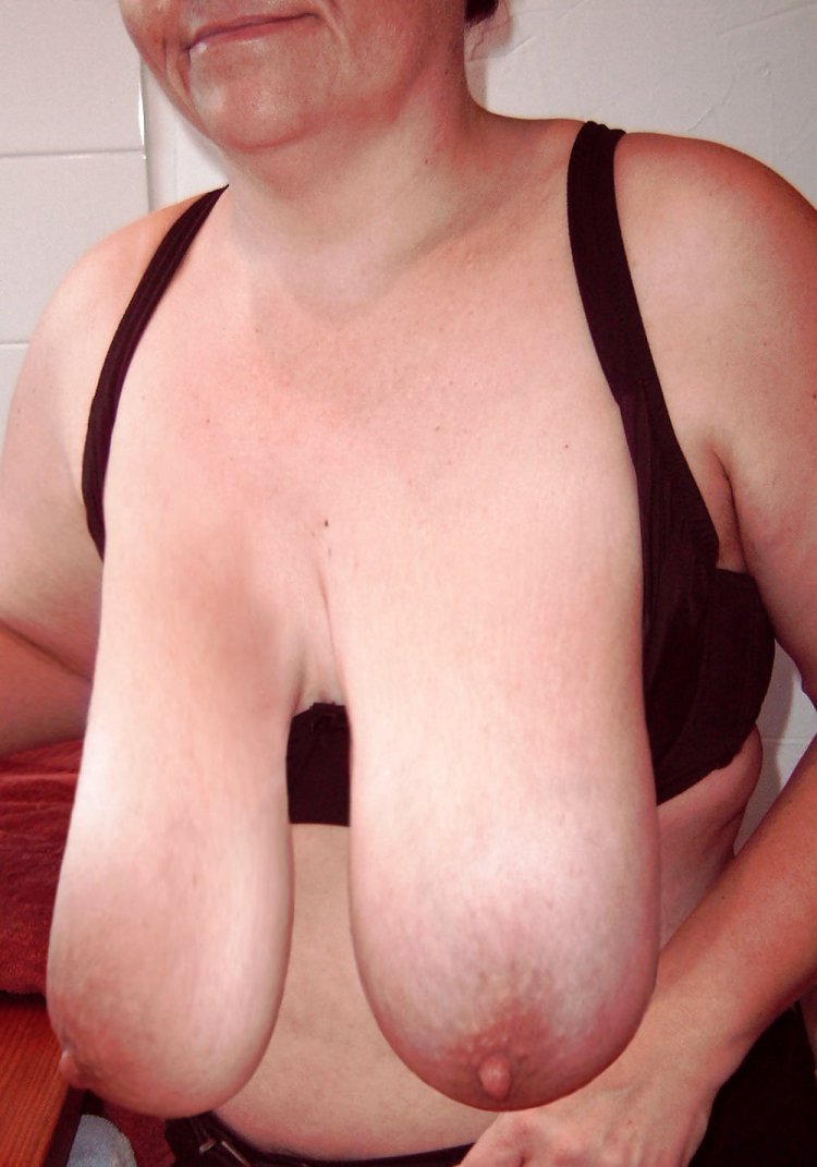 Adult woman with sagging breast