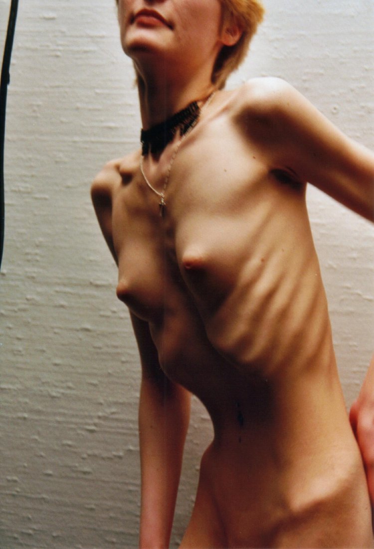 Naked men with anorexia