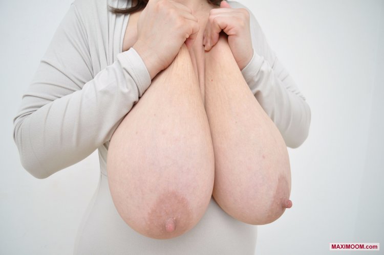 Big breasts of gigantomastia