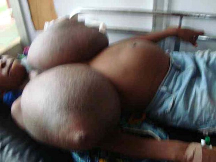 Macomastia big boobs