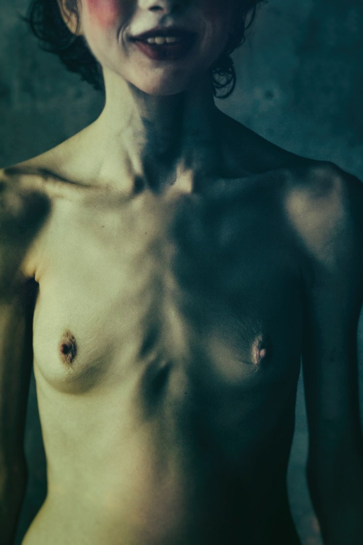 Anorexic with big tits