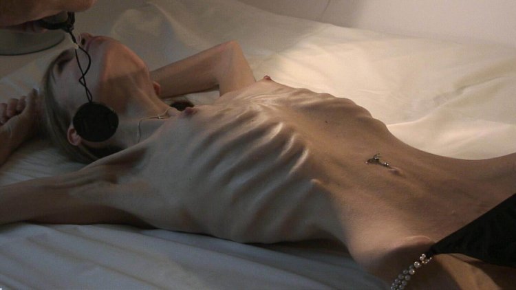 Anorexic guy without panties