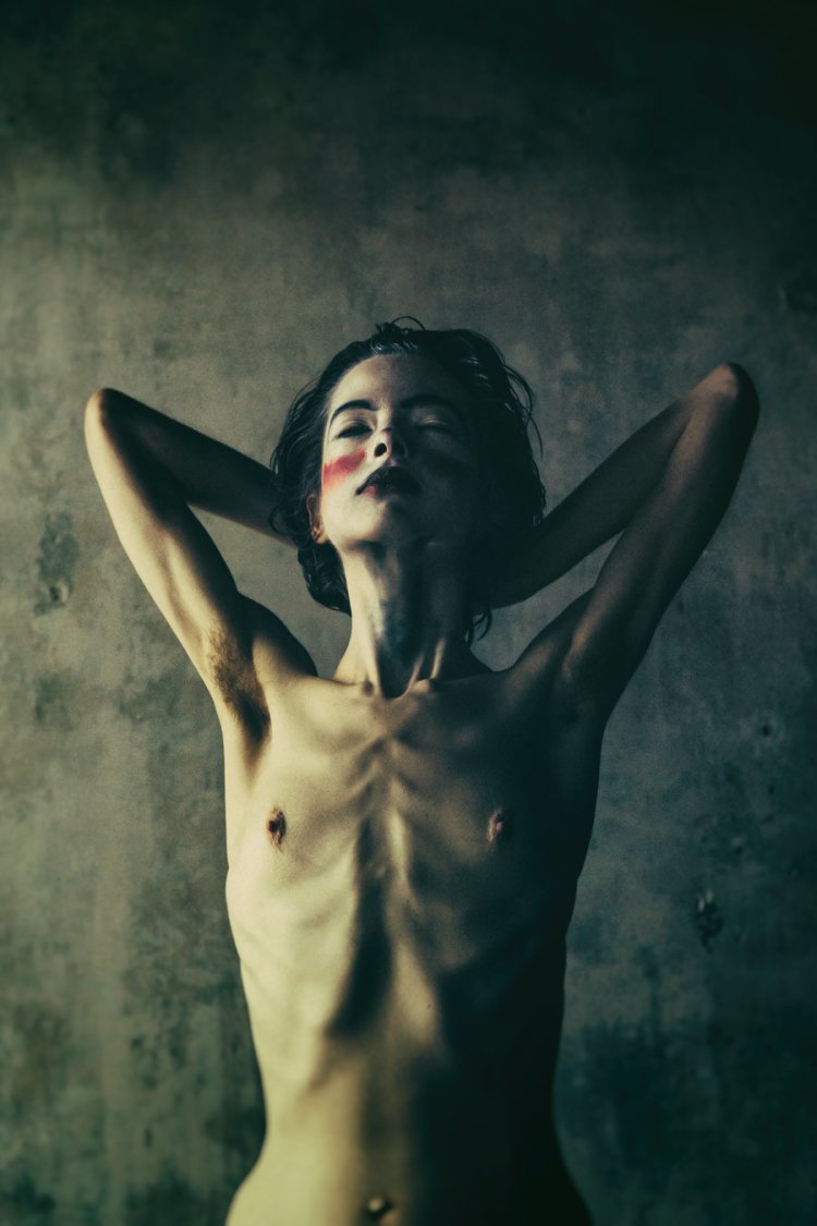 Anorexic with big tits